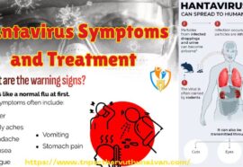 Hantavirus Symptoms and Treatment : ஹான்டாவைரஸ்: அறிகுறிகள் மற்றும் சிகிச்சை
