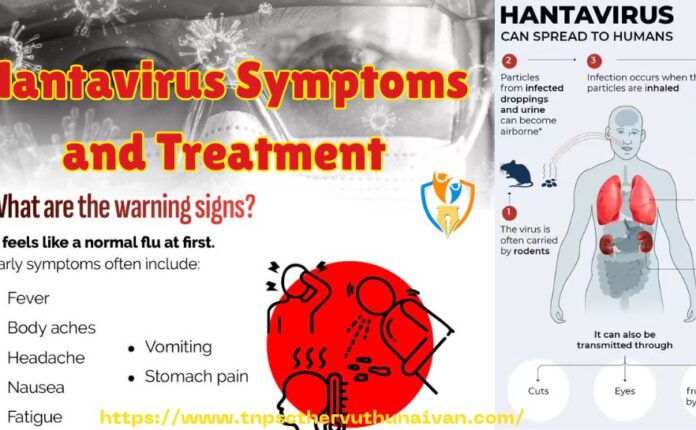 Hantavirus